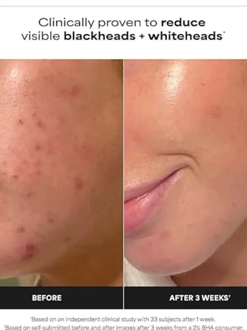 Paula's Choice Black Exfoliant Bottle